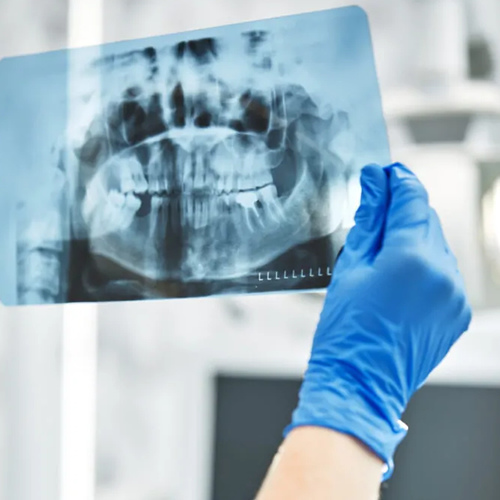 Tratamento de cavitações pela Dra. Maiara em Blumenau